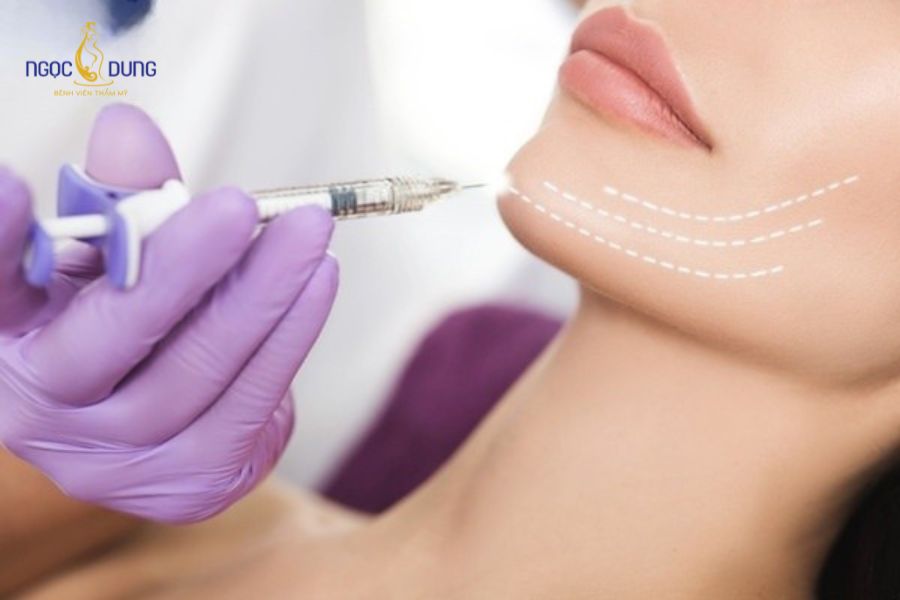 Tiêm botox gọn hàm kiêng gì? Cách chăm sóc da an toàn 12 Thời gian kiêng khem sau khi tiêm botox nên là từ 10-14 ngày