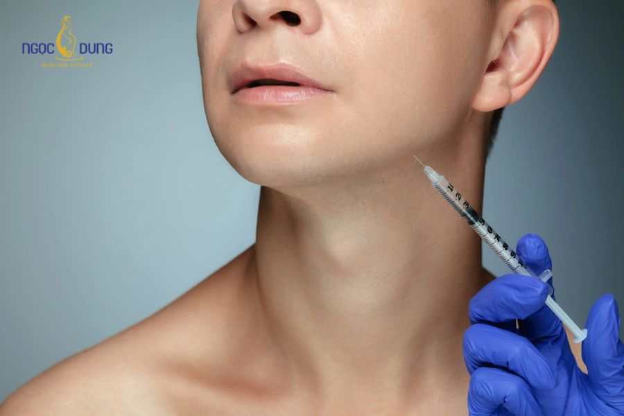 Tiêm botox thon gọn hàm giữ được bao lâu? Yếu tố ảnh hưởng 7 Tiêm botox gọn hàm giúp căn chỉnh khuôn mặt lệch tối ưu