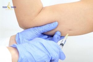 Tiêm botox làm thư giãn và giảm tình trạng co cơ, giúp thon gọn bắp tay
