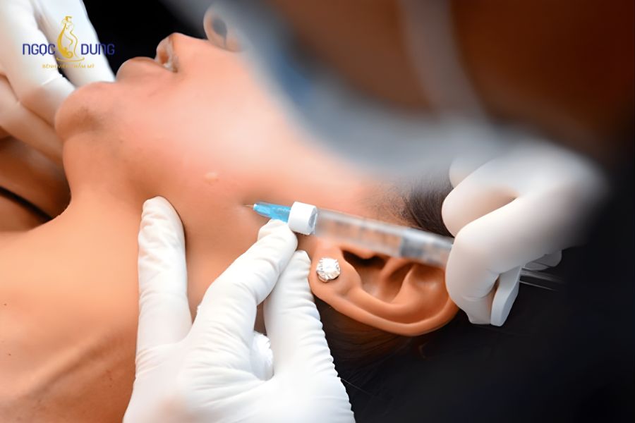 Tiêm botox gọn hàm - Kiến thức cần biết trước khi thực hiện 9 Tiêm botox thon gọn hàm không gây nguy hiểm nếu chọn đúng nơi thực hiện uy tín