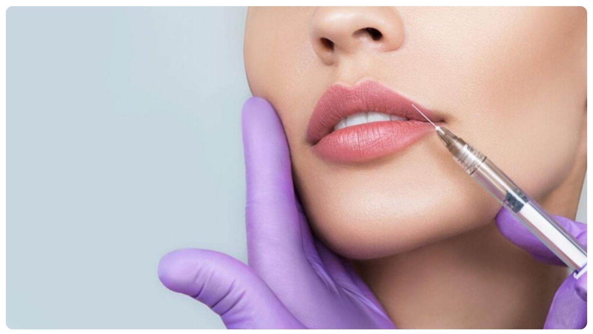 Tiêm filler có hại về sau không? 7 tác dụng phụ thường gặp 13 Tiêm filler có hại về sau không? Câu hỏi nhiều người quan tâm