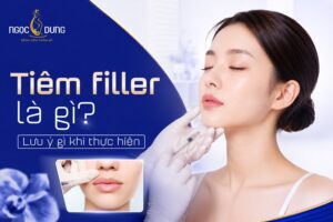 tiem filler la gi