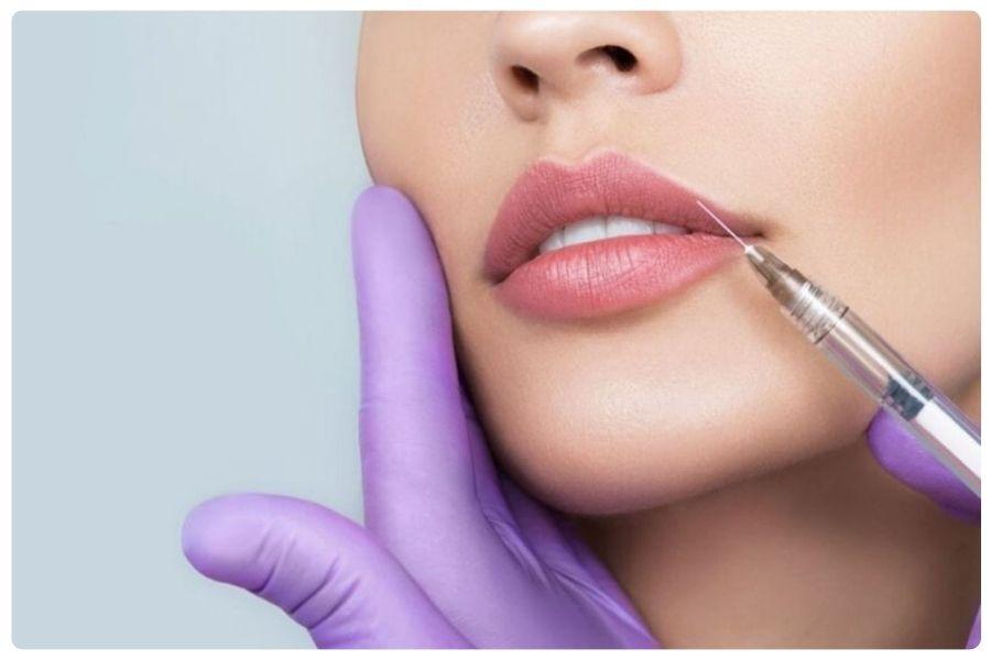 Nên Cấy Mỡ Tự Thân Hay Tiêm Filler? Nên chọn phương pháp nào 10 Tiêm filler là phương pháp làm đẹp có hiệu quả tức thì