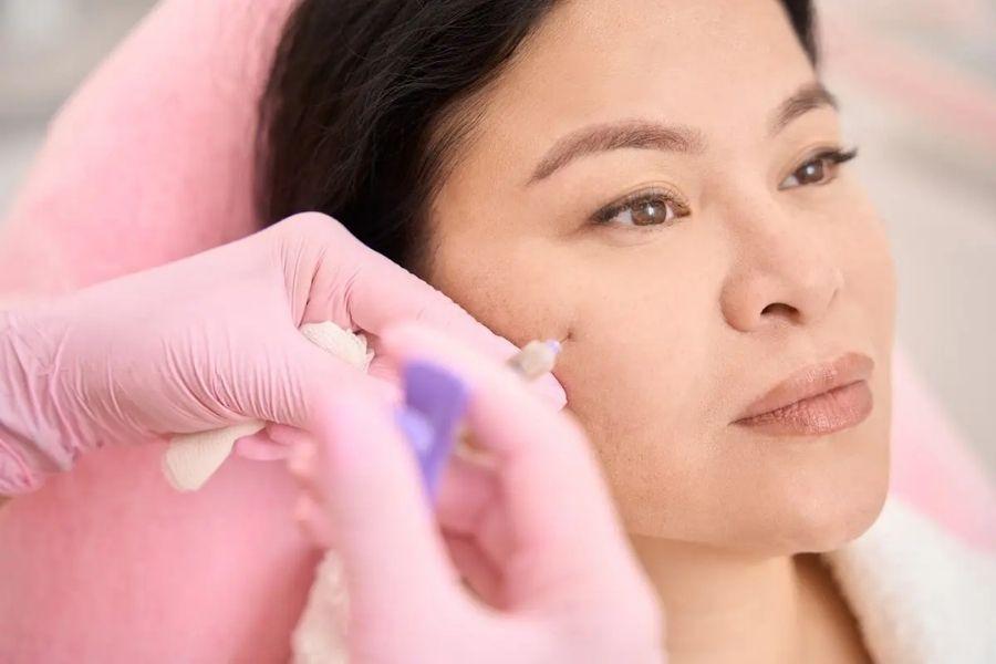 Tiêm filler má là gì? Những lưu ý nên biết khi thực hiện 7 Tiêm filler làm đầy mặt là phương pháp tối ưu nhất cho những ai muốn làm đẹp không xâm lấn