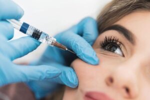 Tiêm filler má là giải pháp thẩm mỹ không xâm lấn được ưa chuộng