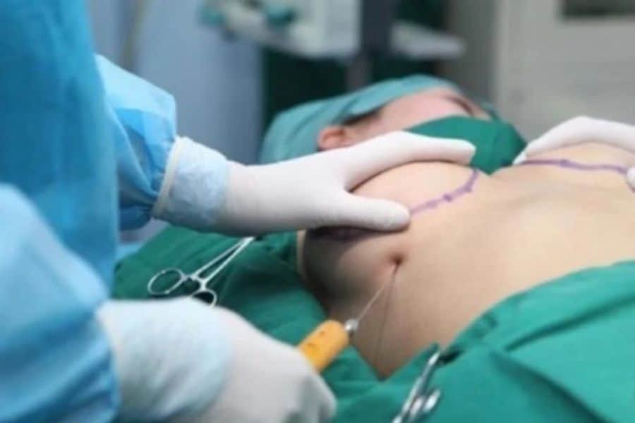 Nâng ngực có được vĩnh viễn không? Yếu tố ảnh hưởng 12 Tuổi thọ túi ngực được bao lâu tùy thuộc nhiều yếu tố