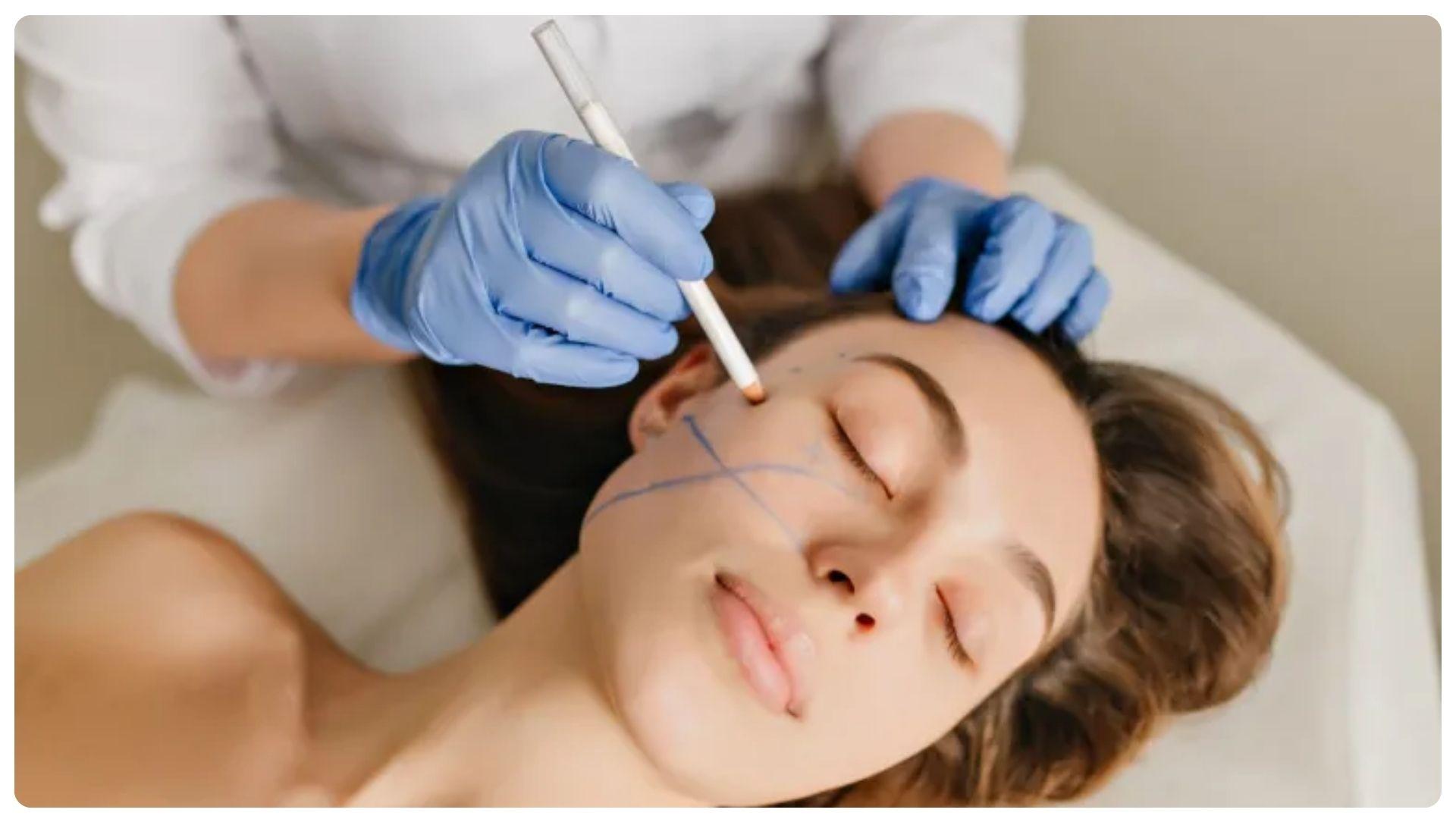 Tiêm filler bao lâu thì vào form? Các yếu tố ảnh hưởng 12 Vùng má là khu vực vào form nhanh và ổn định sớm