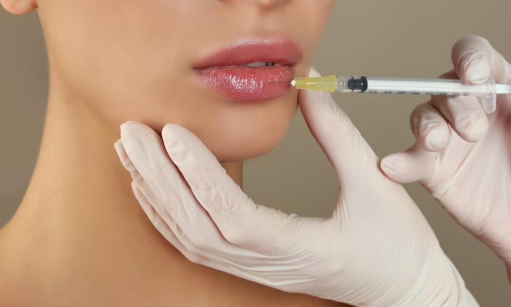 Sau tiêm filler kiêng gì cho mau lành? Thời gian bao lâu 10 word image 8557 4