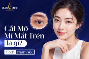 Phẫu thuật cắt mỡ mí mắt trên