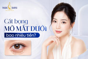Cắt bọng mắt dưới bao nhiêu tiền