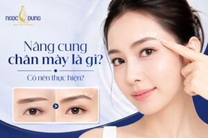 Nâng cung chân mày là gì