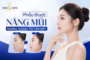 Phẫu thuật nâng mũi