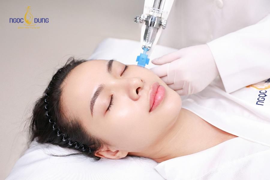 6 Tác hại của tiêm meso: Cần lưu ý trước khi thực hiện 16 Bệnh viện Thẩm mỹ Ngọc Dung là cơ sở tiêm meso uy tín