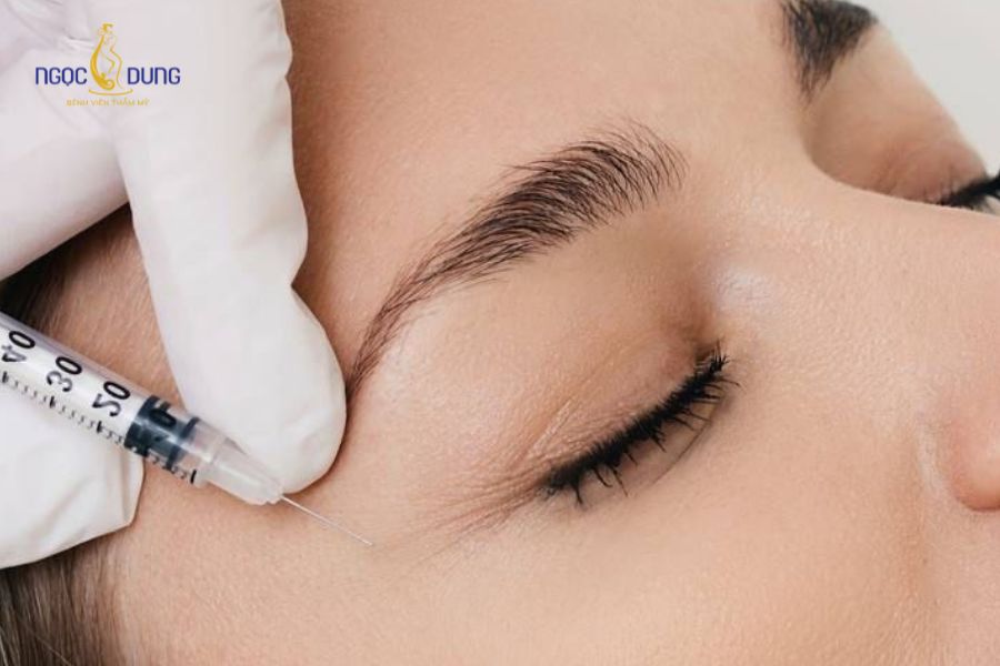 Tiêm filler thái dương là gì? Có nguy hiểm không? 18 Cần chọn cơ sở uy tín thăm khám trước khi tiêm filler thái dương