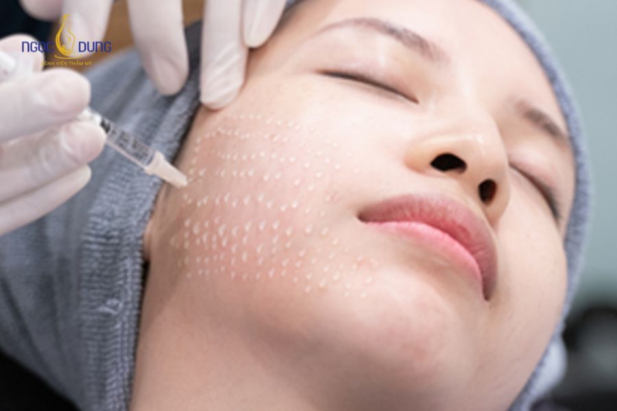 6 Tác hại của tiêm meso: Cần lưu ý trước khi thực hiện 17 Cần lựa chọn cơ sở uy tín để tránh tác hại của tiêm meso