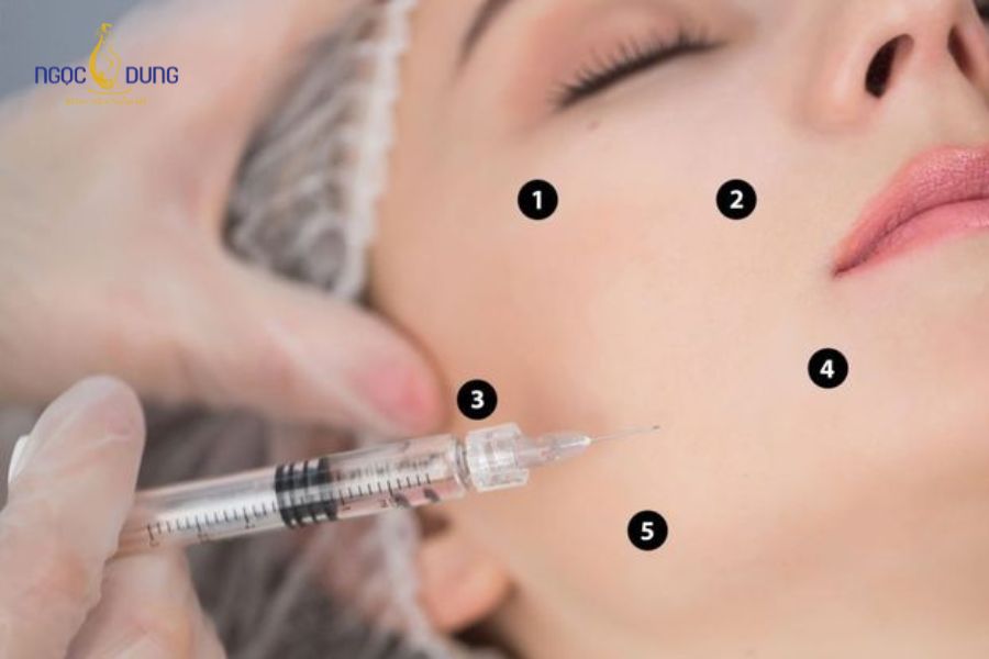 Mẹ bầu tiêm meso được không? Có ảnh hưởng gì đến thai nhi không? 16 Cần thăm khám kỹ trước khi tiêm meso để đảm bảo an toàn