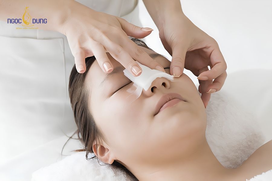 Phẫu thuật nâng mũi: Tổng quan, chỉ định và quy trình thực hiện 11 Chế độ chăm sóc hậu phẫu khoa học quyết định lớn đến tốc độ hồi phục và phom dáng của mũi