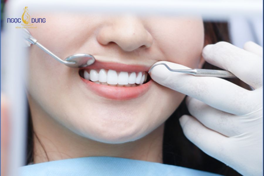 Tiêm Botox Cười Hở Lợi: Giải Pháp Nhanh, Không Phẫu Thuật 8 Cười hở lợi có thể đến từ nhiều nguyên nhân khác nhau
