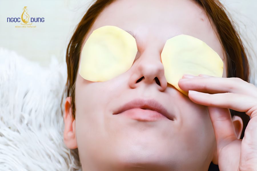 Hướng dẫn cách trị quầng thâm, bọng mắt bằng khoai tây hiệu quả tại nhà 9 Đắp trực tiếp các lát khoai tây tươi ướp lạnh giúp các mạch máu quanh mắt co lại, giảm sưng bọng mắt tức thì