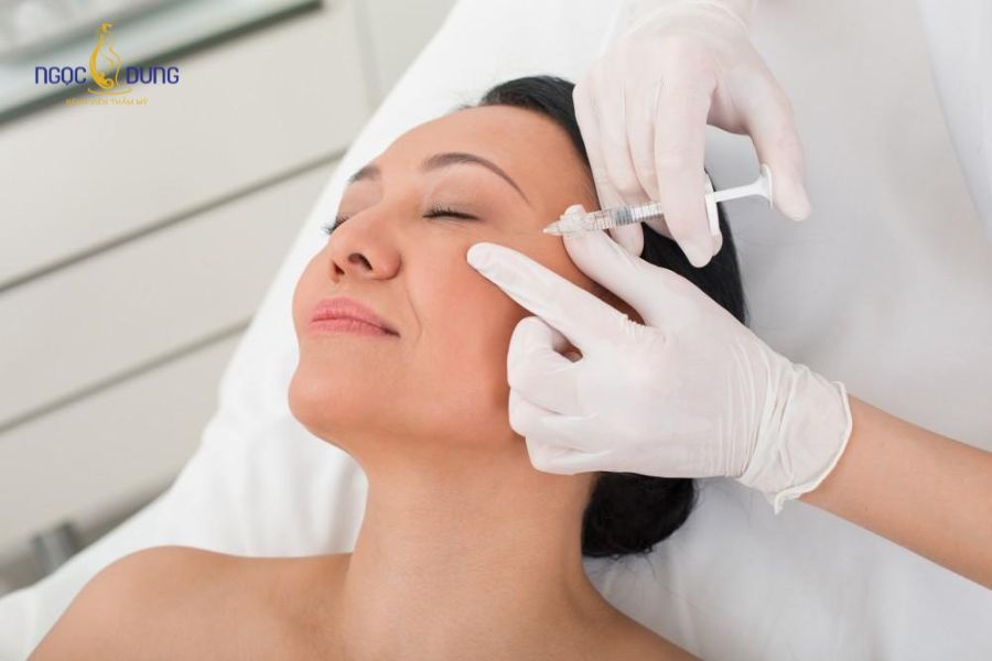 Các loại filler Hàn Quốc được ưa chuộng nhất 2026 23 Filler Hàn Quốc có thể duy trì hiệu quả từ khoảng 9 tháng đến 18 tháng