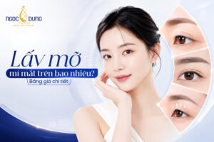 Lấy mỡ mí mắt trên bao nhiêu tiền