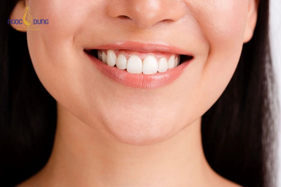 Tiêm Botox Cười Hở Lợi: Giải Pháp Nhanh, Không Phẫu Thuật 12 Giá tiêm botox cười hở lợi có thể chênh lệch tùy vào các yếu tố khác nhau