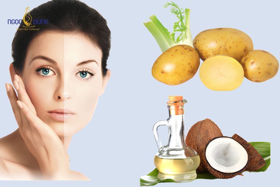 Hướng dẫn cách trị quầng thâm, bọng mắt bằng khoai tây hiệu quả tại nhà 12 Hỗn hợp khoai tây dầu dừa giúp kích thích tuần hoàn máu và làm mờ các nếp nhăn li ti