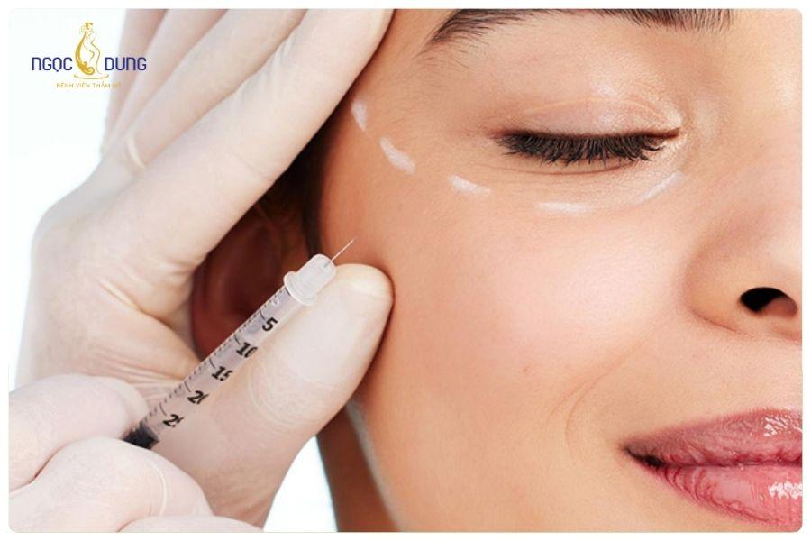 Phân biệt filler và botox khác gì nhau ? Cái nào tốt hơn 9 Kết hợp filler và botox giúp trẻ hóa toàn diện gương mặt