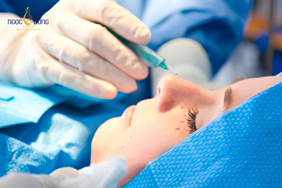 Phẫu thuật nâng mũi: Tổng quan, chỉ định và quy trình thực hiện 9 Lựa chọn phương pháp và chất liệu nâng mũi phù hợp với cơ địa và nền tảng da của từng khách hàng