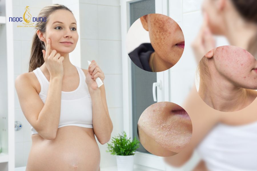 Mẹ bầu tiêm meso được không? Có ảnh hưởng gì đến thai nhi không? 15 Mẹ bầu nên chăm da bằng các phương pháp lành tính