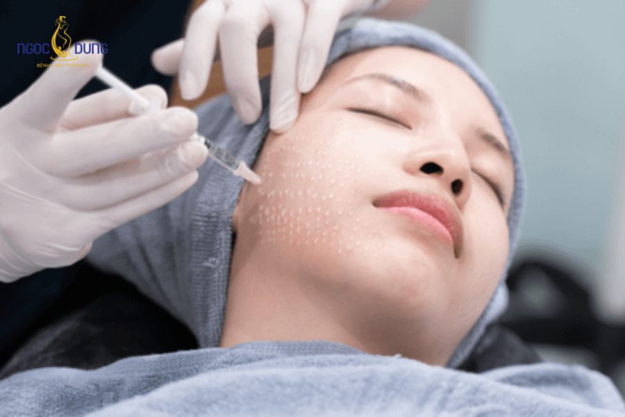 Phụ nữ đang cho con bú có tiêm meso được không? Lưu ý ngay 8 Đang cho con bú có tiêm Meso được không? Mẹ có thể thực hiện tiêm meso sau ít nhất 6 tháng kể từ khi sinh bé