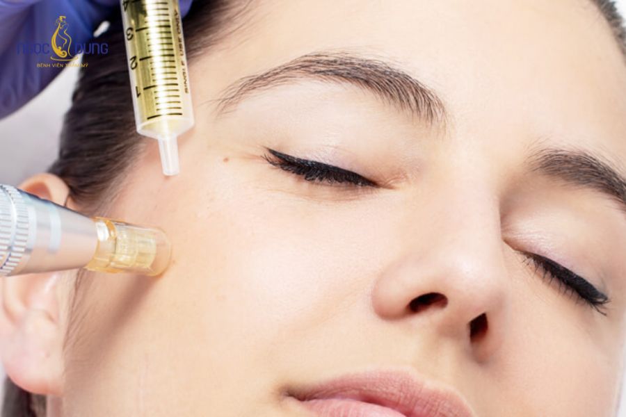 Phụ nữ đang cho con bú có tiêm meso được không? Lưu ý ngay 6 Mesotherapy là một kỹ thuật thẩm mỹ xâm lấn tối thiểu giúp khắc phục khuyết điểm da nhanh chóng