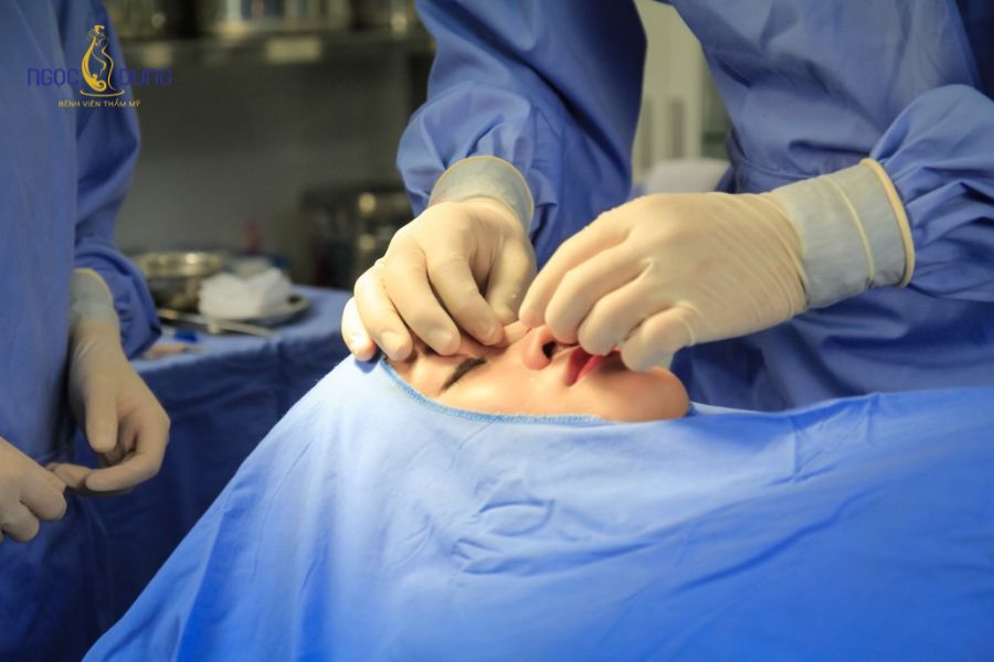Phẫu thuật nâng mũi: Tổng quan, chỉ định và quy trình thực hiện 8 Nếu có khuyết điểm mũi nên được chỉ định can thiệp phẫu thuật nâng mũi