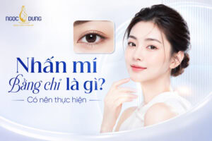 Nhấn mí bằng chỉ