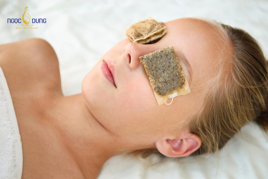 Bọng mắt là gì? Nguyên nhân và cách phòng ngừa bọng mắt hiệu quả 7 Sử dụng trà túi lọc đắp giúp giảm bọng mắt hiệu quả tại nhà