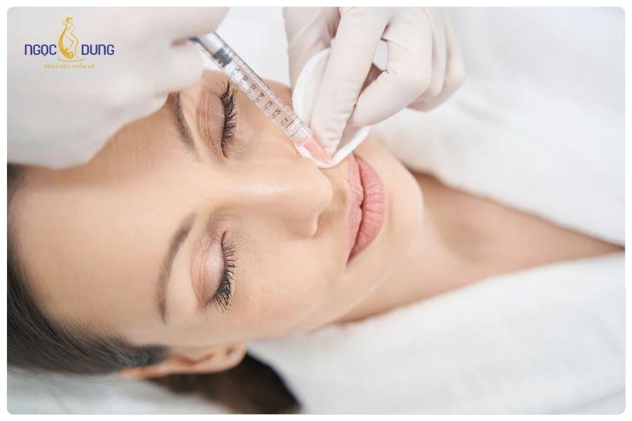 Tiêm tan filler bao lâu thì tiêm lại được? Bao lâu thì tan hết 12 Thời gian tiêm lại filler sẽ khác nhau tùy cơ địa và tình trạng hồi phục