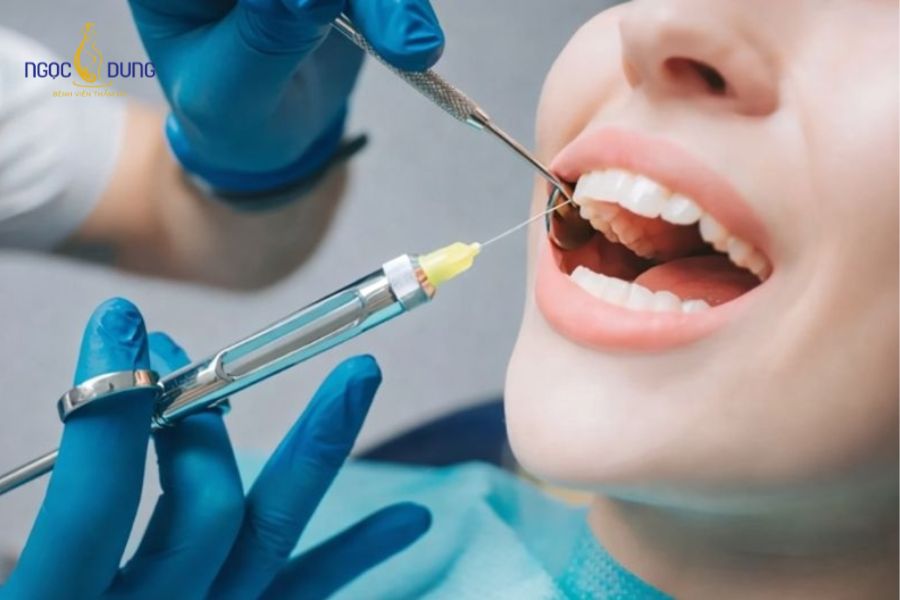 Tiêm Botox điều trị hở lợi giúp môi trên hạ thấp và bao phủ phần nướu tự nhiên