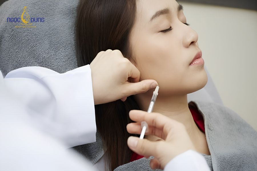 Tiêm botox gọn hàm bao lâu thì gọn? Duy trì được bao lâu 7 Tiêm botox gọn hàm bao lâu thì gọn. Có thể duy trì được khoảng 3 - 9 tháng tùy theo cơ địa và cách chăm sóc