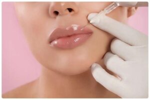 Tiêm filler bao lâu thì mềm là thắc mắc của người