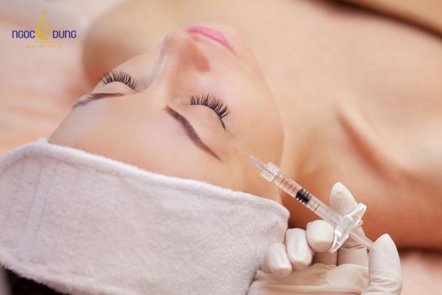 4 cách có bọng mắt tự nhiên, đẹp tại nhà đơn giản và dễ dàng 12 Tiêm Filler bọng mắt cười là lựa chọn được rất nhiều người ưa chuộng hiện nay