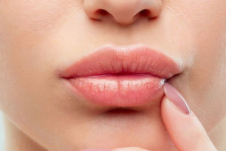 TOP 10+ dáng môi tiêm filler đẹp tự nhiên và HOT TREND hiện nay 11 Tiêm filler dáng môi Tây rất được yêu thích