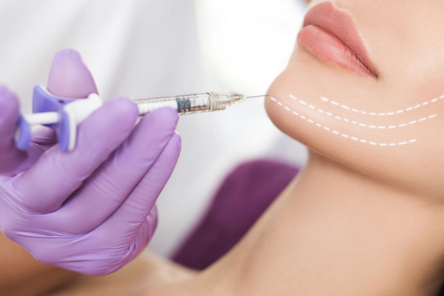 Đang cho con bú tiêm filler được không? Thời gian được tiêm 9 Tiêm filler giúp cải thiện đường nét khuôn mặt