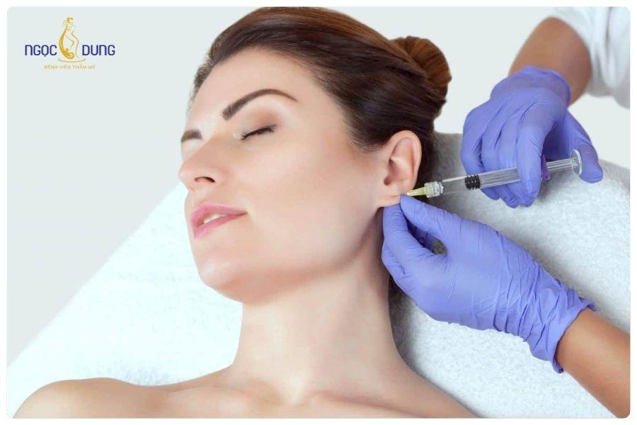 Tiêm filler tai tài lộc có an toàn không? Những điều bạn cần biết 14 Tiêm filler tai giúp cải thiện dáng dái tai mỏng, nhỏ hoặc thiếu cân đối