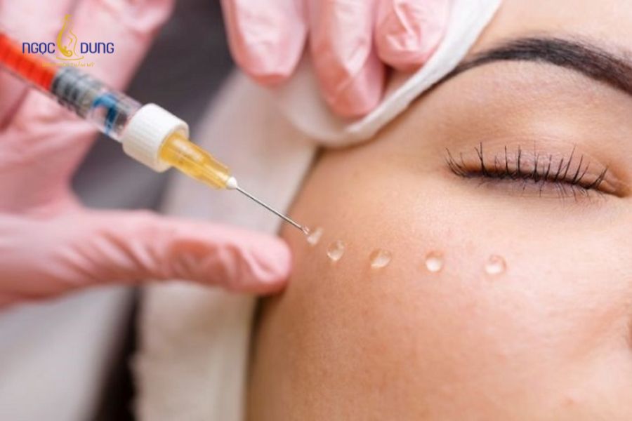 Tiêm meso trị nám có hiệu quả không? Cơ chế hoạt động và lưu ý 14 Tiêm meso có chi phí hợp lý