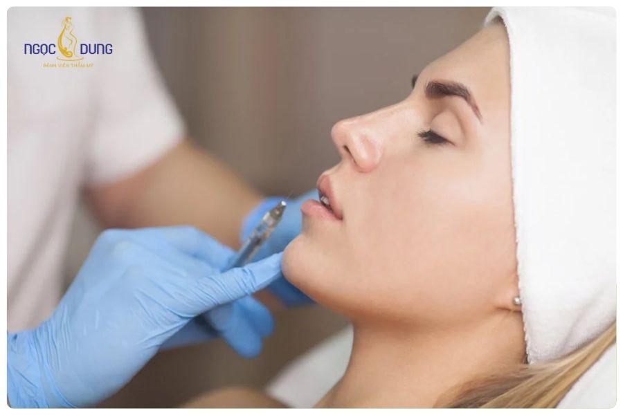 Tiêm tan filler bao lâu thì tiêm lại được? Bao lâu thì tan hết 10 Tiêm tan filler bao lâu thì tiêm lại được? Bao lâu thì tan hết