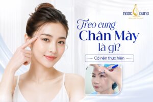 Treo cung chân mày