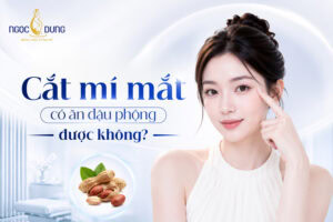 cắt mí mắt có ăn đậu phộng được không