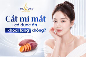 cắt mí mắt có được ăn khoai không