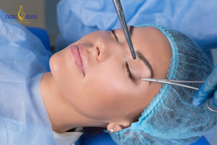 5 phương pháp cắt mí đẹp, thông dụng hiện nay 19 Bác sĩ chỉ định công nghệ cắt mí dựa trên mức độ da chùng và bọng mỡ thực tế