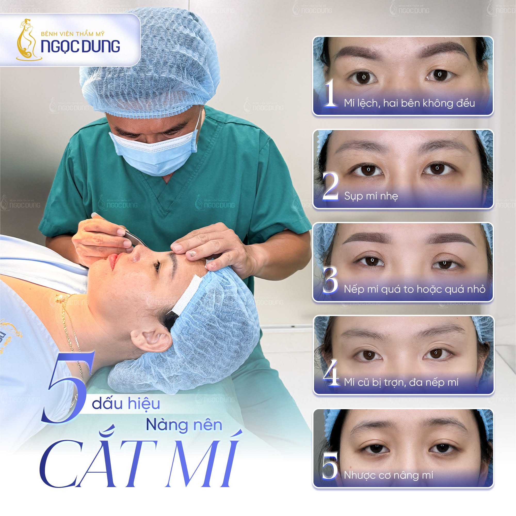 Phẫu thuật cắt mí Plasma: Thông tin cần biết từ A - Z 12 Bác sĩ Ngọc Dung thăm khám và định hình dáng mí phù hợp cho từng khuyết điểm mắt của khách hàng